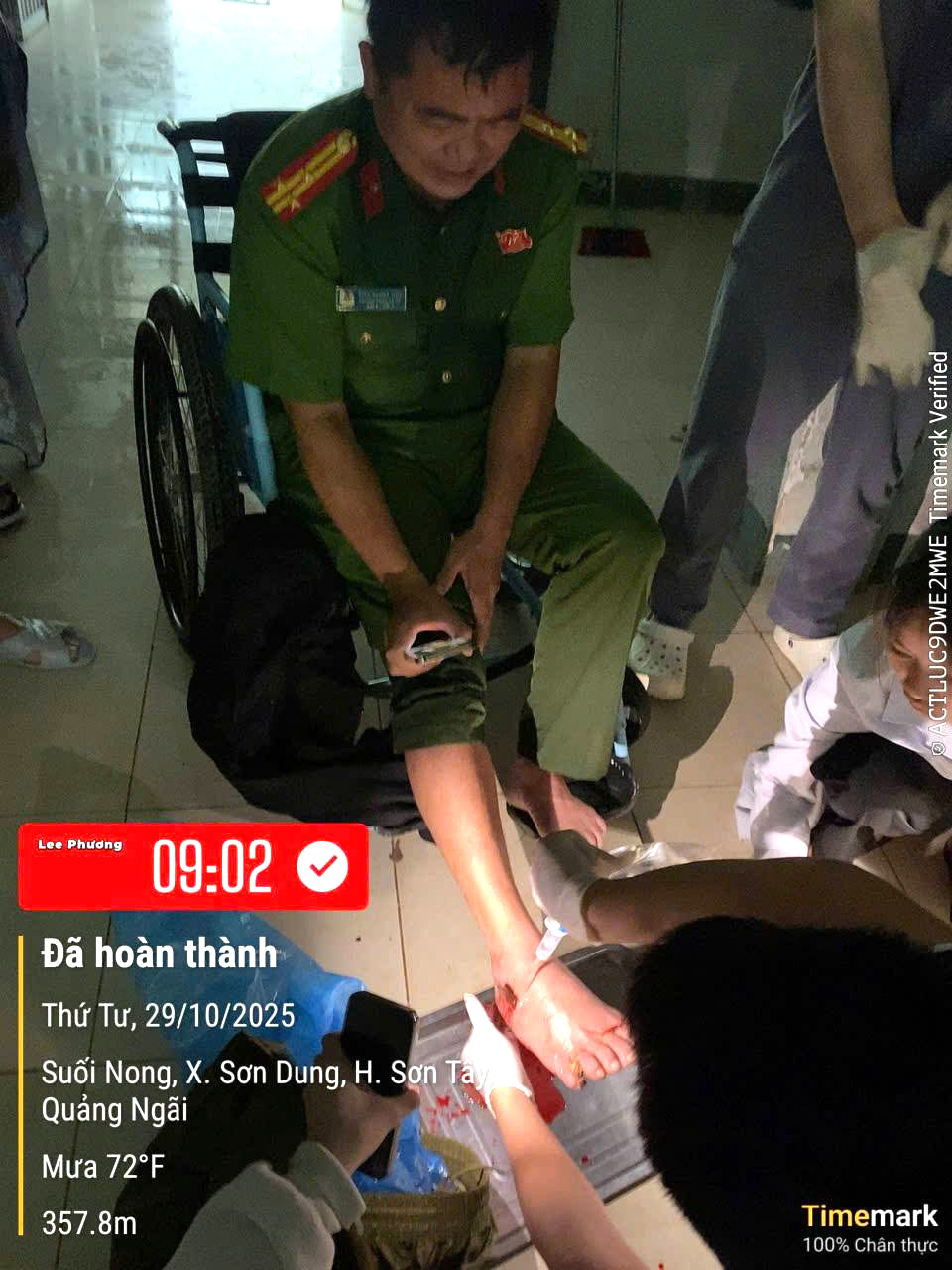 广南省一乡公安局长在帮助民众抗洪时被木棍刺穿脚掌